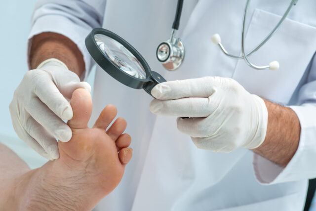 Після обстеження міколог призначає засоби проти грибку нігтів